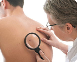 Симптомы плоскоклеточного рака кожи