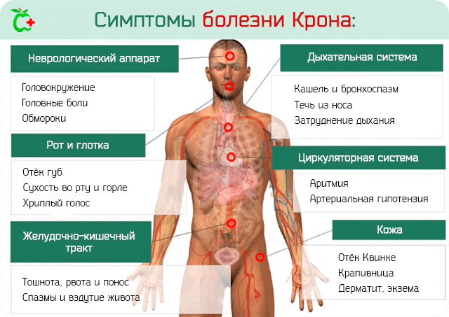 Лечение болезни  в Израиле, отзывы на форуме клиники Ихилов