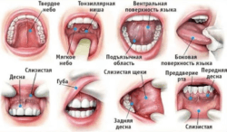 Как выглядит рак слизистой на фото / Лечение онкологии в Израиле в клинике Ихилов